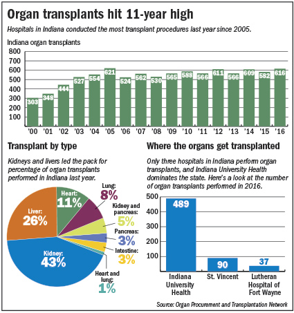 transplant-charts.jpg